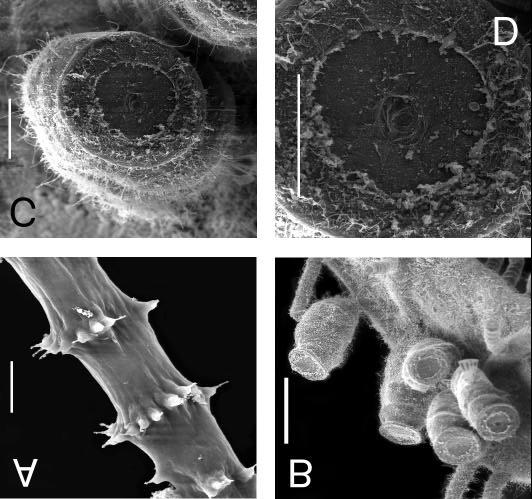 Figura 9. Clytia cf. gracilis sp.2. Fotomicrografias eletrônicas de varredura. A. Detalhe de um tentáculo de hidrante, com anéis de nematocistos do tipo A; B.