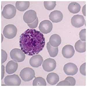 Imagem 20 Basófilo Monocitopoese e Linfocitopoese ara a série agranulocítica linfocítica, as UF-Li originam o linfoblasto que tem citoplasma basófilo.