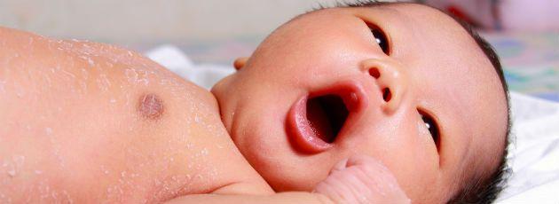 Características Clínicas O bebê pós-termo pode ser grande, pequeno ou de tamanho apropriado.
