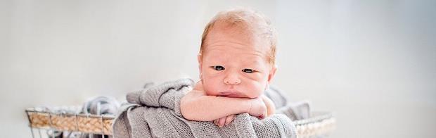 Quando existe insuficiência placentar na gestação pós-termo, é possível que o feto apresente os sinais clínicos da síndrome da pós-maturidade ou síndrome de Clifford, descrita pelo Dr.