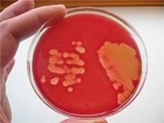 INTRODUÇÃO Streptococcus