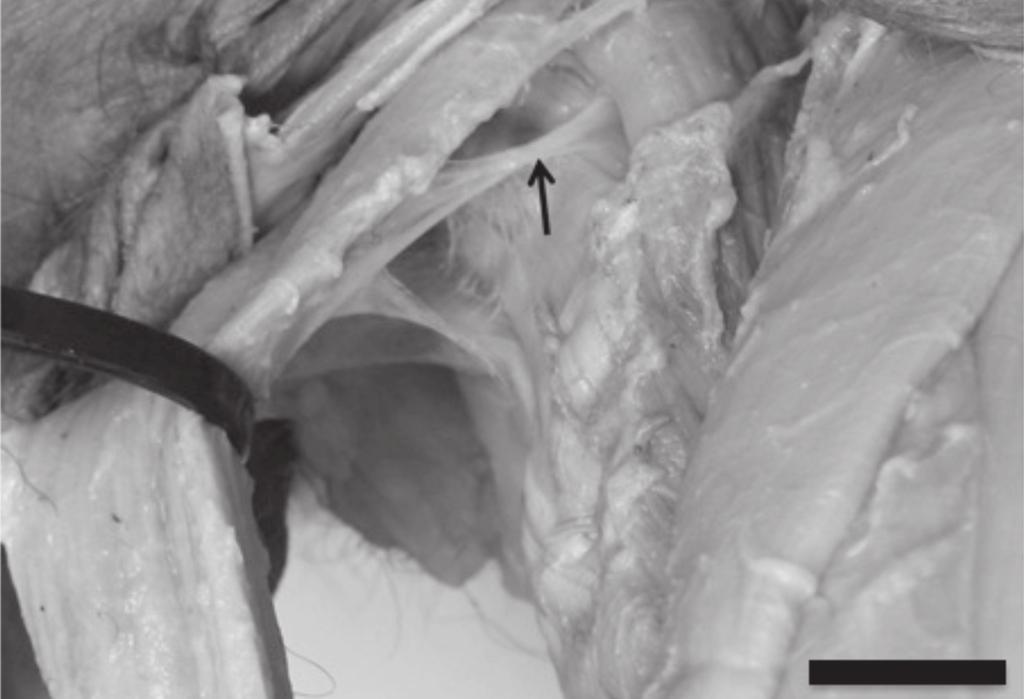 264 Roqueline A.G.M.F. Aversi-Ferreira et al. the vastus medialis muscle, 1 branch to each vastus medialis and lateralis muscle, and 2 branches to the rectus femoris muscle.