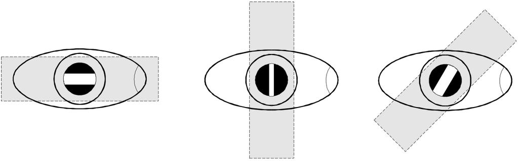 G) O optometrista deve utilizar o OD para avaliar o OD do paciente e o OE para avaliar o OE do paciente (observação consensual).