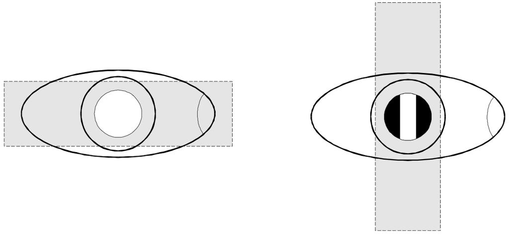 N) Realizar o mesmo procedimento para o OE, sendo que o OD já estará miopizado uma vez que possuiu o valor total da retinoscopia, ajustando a potência das lentes até que o paciente tenha uma AV