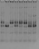 compostas. Trata-se de uma técnica que é caracterizada pela simplicidade e que, após a etapa de extração do DNA, é necessária apenas a realização da PCR e eletroforese dos fragmentos (Figura 1).