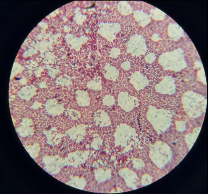 Figura 2: Presuntiva cepa hospedeira de Enterococos (hidrólise da esculina e Gram-positiva).Fonte: Autor do Trabalho.