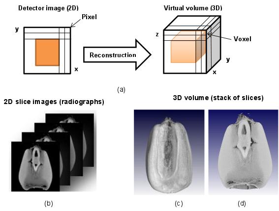 Figura: Tomografia computadorizada para