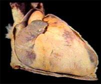 Camadas da Parede Cardíaca A superfície anterior fica logo abaixo do esterno e das costelas.