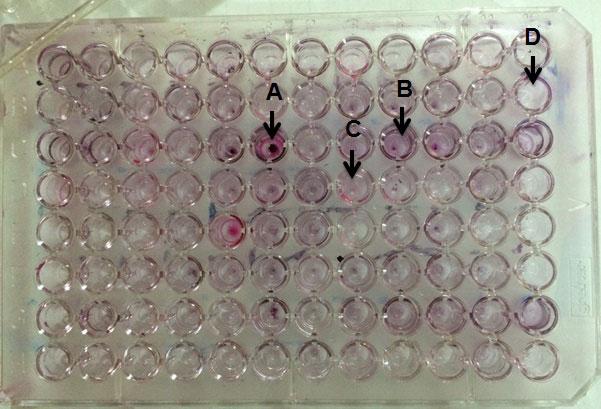 penicilina nos isolados de Staphylococcus de acordo com o sítio. Figura 2. Fenótipo MLS B indutivo do S.