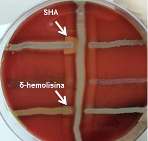 Suscetibilidade Antimicrobiana e Fatores de Virulência de Staphylococcus em Fômites do Hospital Universitário Sul Fluminense Figura 4: SHA positivo de S. Saprophyticus e ä- hemolisina de S.