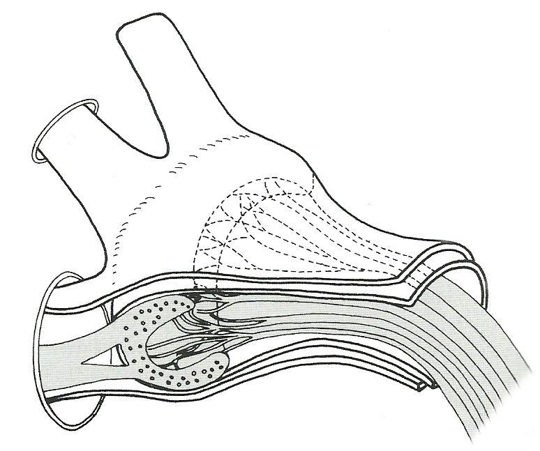 N. Oftálmico (V1) (fissura orbital superior) N.