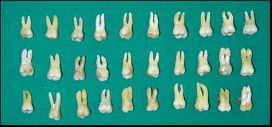 35 Figura 1 - Dentes molares superiores.