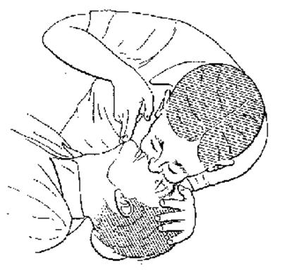 Em crianças podemos colocar a boca sobre o nariz e a tomando o cuidado de não expirar com excessiva pressão.