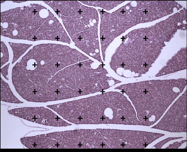 Figura 7. Quantificação da densidade de volume de gordura pancreática.