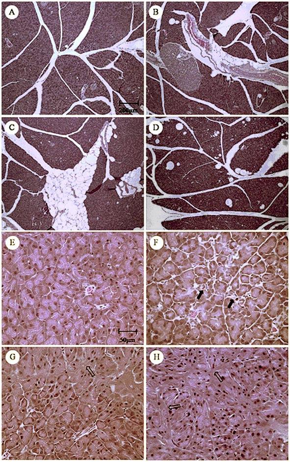 Figura 16. Fotomicrografias do tecido pancreático mostrando os achados mais frequentes.
