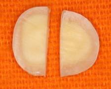 04. Figura 5 Seqüência de corte dental para obtenção de um disco de dentina com 2m