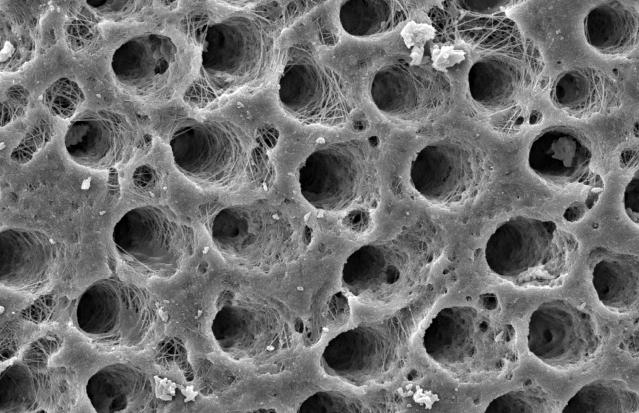 92 Figura 13 Aspecto morfológico da dentina após utilização do