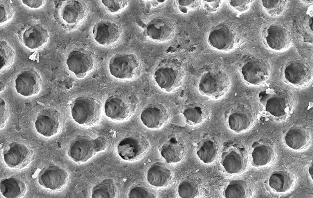 Figura 21 Aspecto morfológico da dentina após utilização do Cristal de uréia como agente clareador