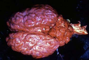 23 A figura 2 demonstra um cérebro bovino congesto infectado por B. bovis. Figura 2- Cérebro bovino congesto infectado por B. bovis. 3.6.2. B. bigemina A infecção por B.