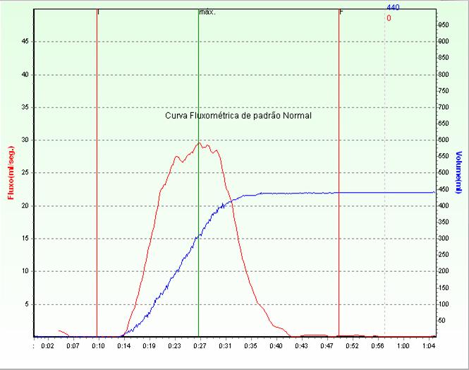 19 3. 3. Diagnóstico e Tratamento dos Distúrbios Miccionais da Infância A avaliação inicial inclui história clínica detalhada além de história obstétrica pregressa, atentando para referências à