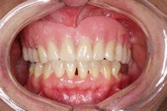 35 periodontal.