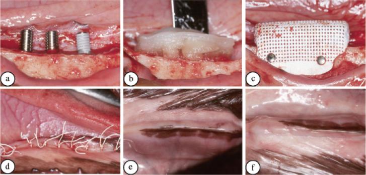 33 Figura 5: (a) defeito ósseo supra-alveolar criado e colocação dos implantes, dois maquinados e um de superfície tratada; (b) colocação de