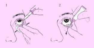 Cuidados gerais de enfermagem ao administrar medicamentos por via ocular: Observar os 9 certos ;