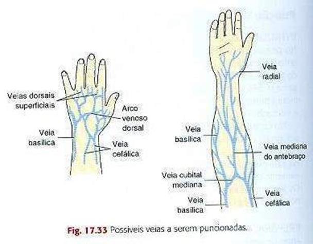 Possíveis veias a