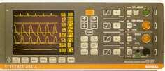 Anos 80 Os monitores começaram a usar telas coloridas, as redes de monitorização tornaram-se mais sofisticadas e com mais informação.