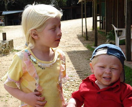 ALBINISMO ORIGEM: Nos indivíduos albinos (1/17000) os melanócitos (células dendríticas presentes entre a derme e epiderme) não produzem melanina, porque a enzima tirosinase não está funcional, não
