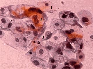 15 - Nucléolos bem pequenos, porém inexistentes, na maioria das vezes; - A carioteca levemente irregular a lisa; - As bordas da membrana citoplasmática apresentam-se preservadas e distintas; -