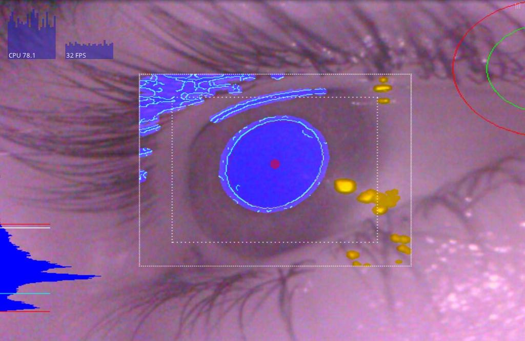 Câmera infravermelho Processamento de imagens do olho Função