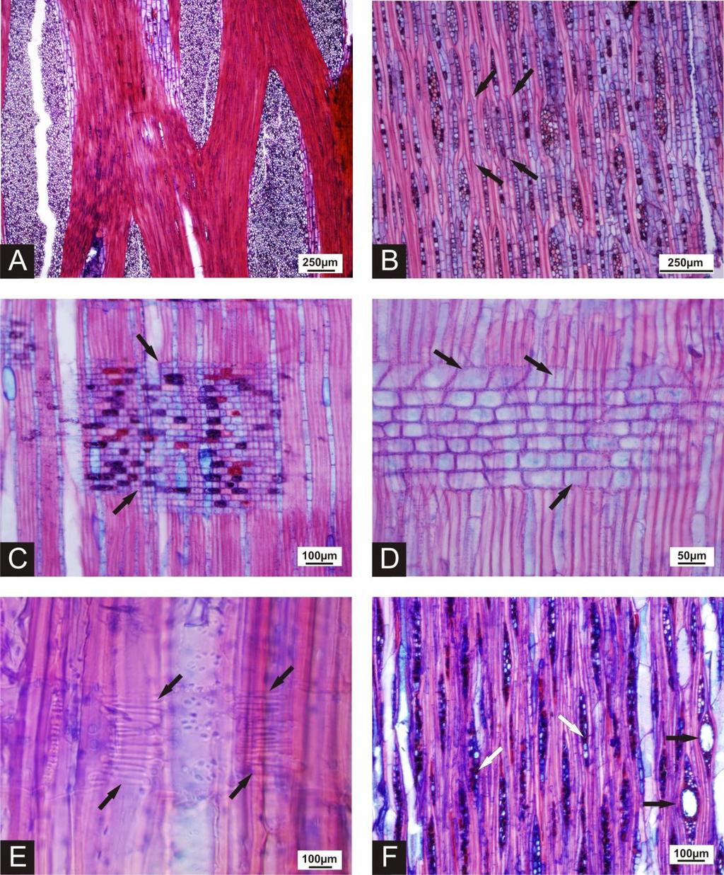 25 Figuras 3 - A - Secção longitudinal tangencial de Roupala montana. Raios com até 38 células de largura, típico da família (Proteaceae). B - Secção longitudinal tangencial de Luehea divaricata.