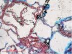 / Figura 11 Aspectos da fácies A4, em lâmina petrográfica (nicol paralelo), mostrando detalhes dos coatings de clorita em