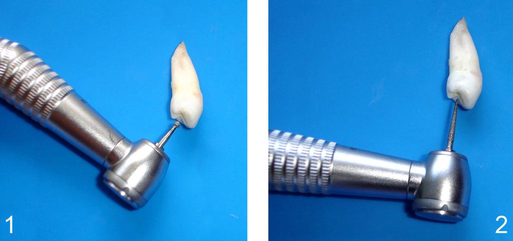28 3 MATERIAIS E MÉTODOS Foram selecionados para este experimento 40 dentes humanos extraídos (pré-molares inferiores), com raízes completamente formadas e isentos de tecidos moles e cálculos.