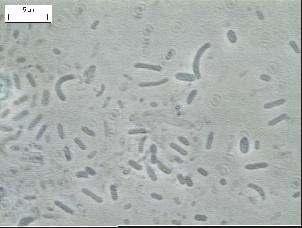 dimensões, (b) bacilos fluorescentes (c)