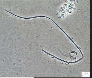 Morfologias observadas sob microscopia óptica de