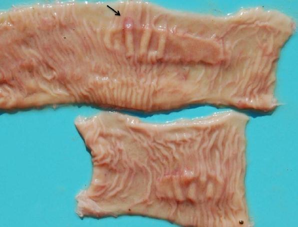 FIGURA 5: Placas de Peyer evidentes na mucosa do intestino delgado, área focal de ulceração delimitada por halo hiperêmico (seta). Adaptado de Santos, 2010.
