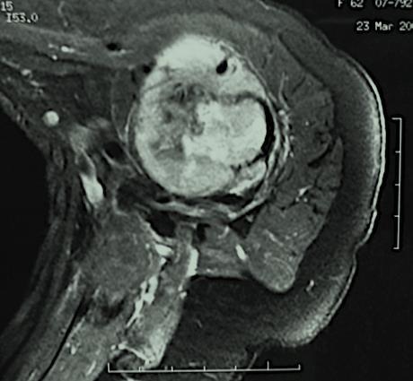 Cirurgia de