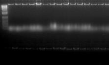 O precipitado DNA/RNA foi ressuspendido em tampão Tris-EDTA, ph 8,0 e quantificado em gel de agarose 0,8%, corado com brometo de etídeo (Figuras A e B).