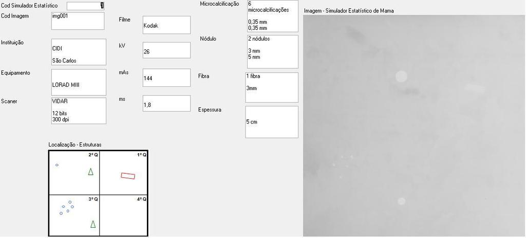 Capítulo 7 Resultados e Discussões Aplicações em Técnicas de Processamento de Imagens Mamográficas Digitais 110 Tal simulador (STEMBERG, SCHIABEL, GUIMARÃES; 2009) tem por característica principal