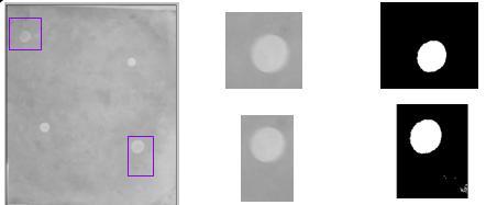 Capítulo 7 Resultados e Discussões Aplicações em Técnicas de Processamento de Imagens Mamográficas Digitais 127 A Figura 7.