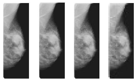 Capítulo 2 - Mamografia 22 (a) (b) (c) (d) Figura 2.