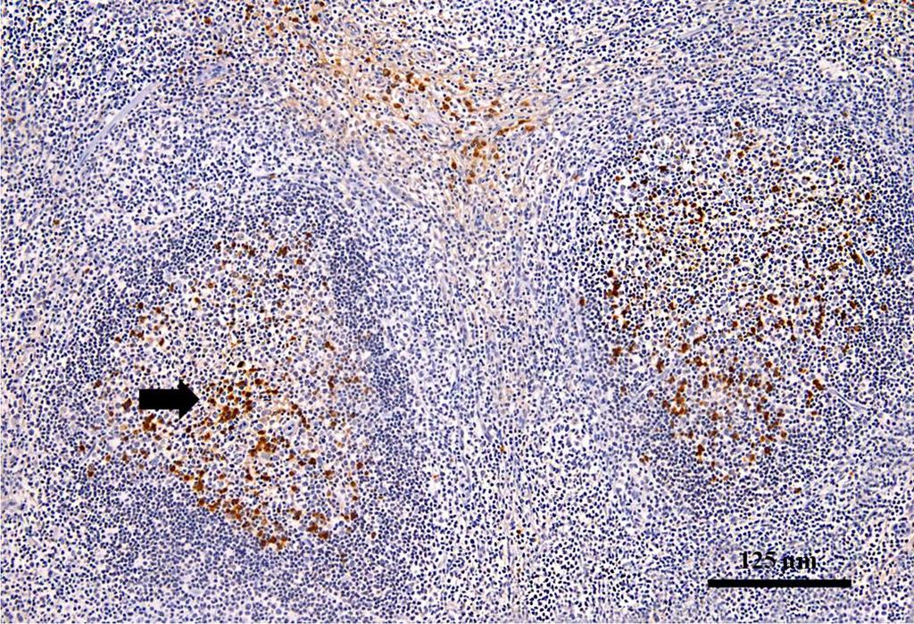 26 germinativos de folículos sugere também o envolvimento de células B em infecções priônicas. Fig.4.