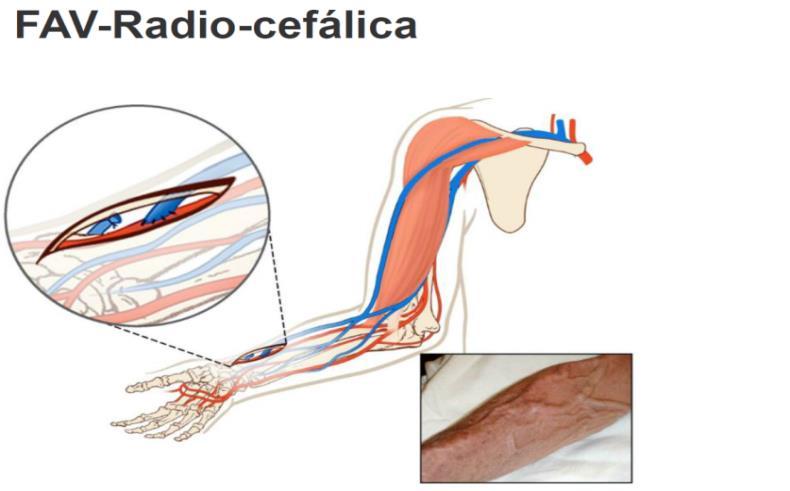 dependem de tecnologia avançada para sobreviver, apresentam limitações no seu cotidiano e vivenciam inúmeras perdas e mudanças biopsicossociais que interferem na sua qualidade de vida tais como: a