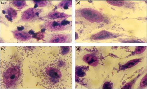 bacteriana compacta, promovendo e estabilizando a interconexão entre as bactérias (GIRÓN et al., 1993). Por outro lado, as aepec podem aderir ou não a células epiteliais em cultura.