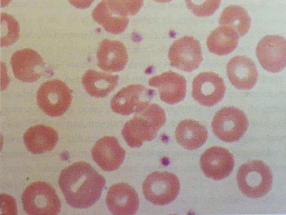 AS PLAQUETAS Embora sejam pequenas, as plaquetas são células do sangue, responsáveis por elaborados processos bioquímicos envolvidos na hemostasia, trombose e coagulação do sangue.