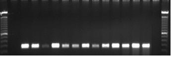 Os resultados podem ser visualizados nas Figuras 4, 5, 6, 7, 8, 9, 10, 11 e 12. 1 2 3 4 5 6 7 8 9 10 11 12 13 14 15 16 500 pb Figura 4 - Produtos da amplificação do gene prfa (467pb).