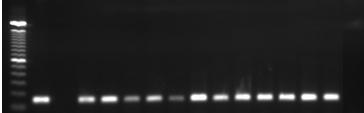 monocytogenes isoladas de carcaça bovina, Coluna 16: controle negativo da reação.