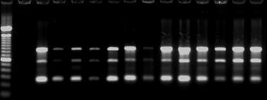 monocytogenes ATCC 7644, Coluna 15: S.